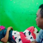 Minum Obat, Wajah Pria Ini jadi Lebam, Opname 7 Hari di Rumah Sakit