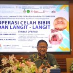 FKG UGM Gelar Operasi Celah Bibir dan Langit-Langit, Gratis, Simak Informasinya